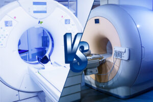 TAC vs. Resonancia Magnética: ¿Cuándo se recomienda cada una?